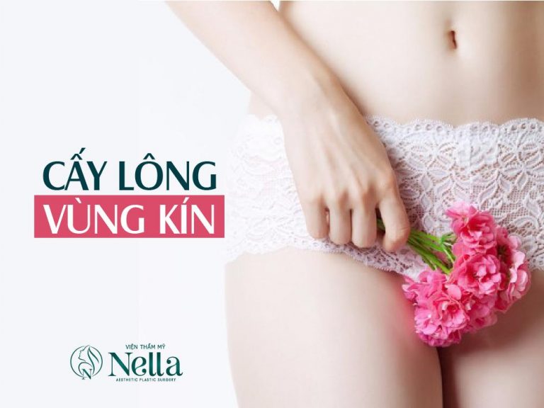 CẤY LÔNG VÙNG KÍN