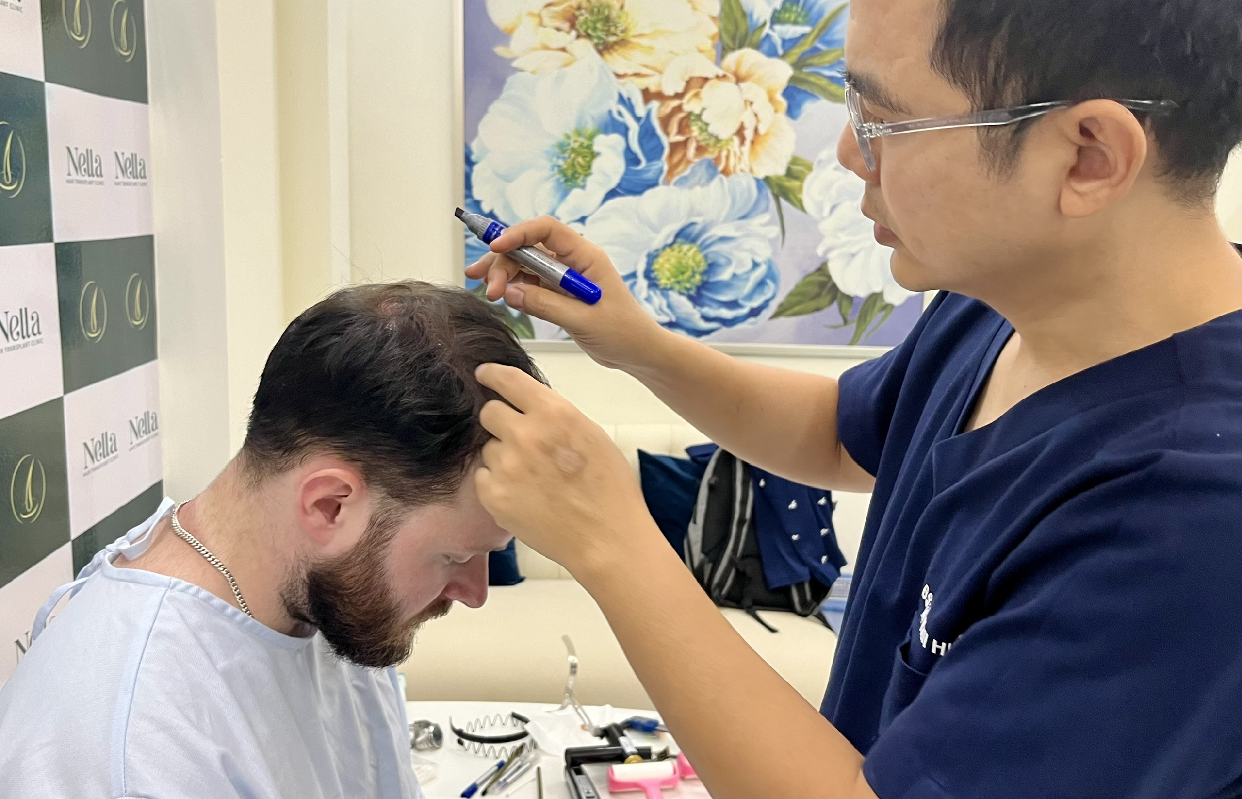 hair transplant vietnam